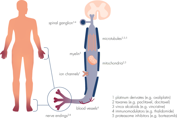 Neuropathic Pain